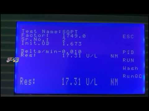 Sgpt Test Sgpt Test In Hindi Principle Procedure And Normal Range Youtube