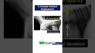 Tracheal Displacement: Key Sign of Esophageal Disease in Dogs #shorts