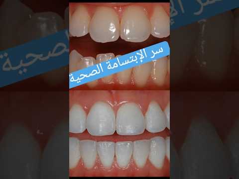 فوائد المضمضة بزيت جوز الهند