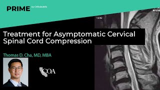 Treatment for Asymptomatic Cervical Spinal Cord Compression  Thomas D. Cha, MD, MBA