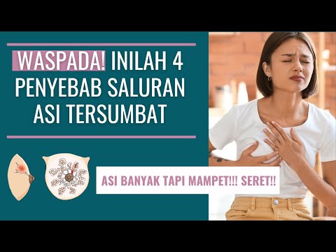 PENYEBAB SALURAN ASI TERSUMBAT | CLOGGED MILK DUCT