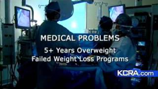 Is Lap-Band Surgery Worth It?