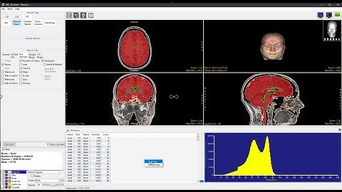 Analyze 15.0 - Measure: Selected Object Histograms