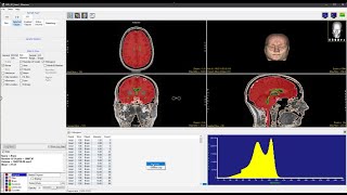 Analyze 15.0 - Measure Selected Object Histograms