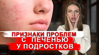 НЕОЧЕВИДНЫЕ ПРИЗНАКИ НАРУШЕНИЙ ПЕЧЕНИ У ПОДРОСТКОВ: ЛИШНИЙ ВЕС, АКНЕ, УСТАЛОСТЬ, ПРЫЩИ,ЧТО ДЕЛАТЬ?