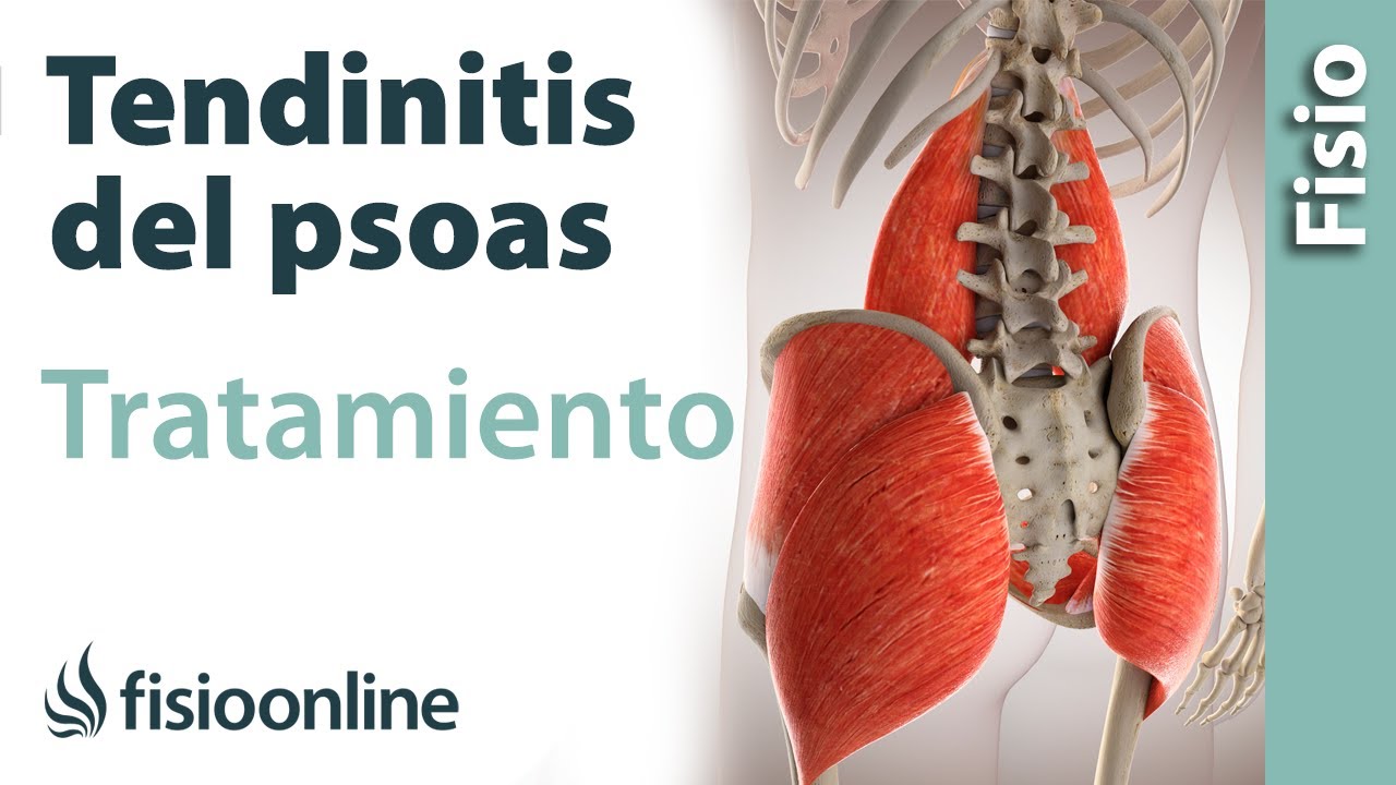 Musculo psoas como desbloquear