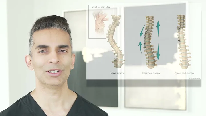 Scoliosis Treatment Options Explained