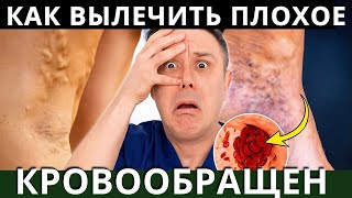 видео: ИСПРАВЬТЕ ПЛОХОЕ КРОВООБРАЩЕНИЕ – Как улучшить кровообращение и очистить артерии и вены картинка: ИСПРАВЬТЕ ПЛОХОЕ КРОВООБРАЩЕНИЕ – Как улучшить кровообращение и очистить артерии и вены