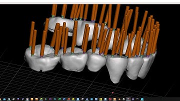 add support to provisional bridge with Meshmixer