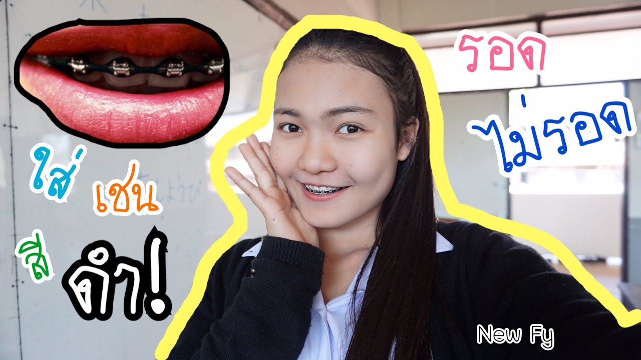 สี ยาง จัด ฟัน สี ดํา  Update New  จัดฟัน..?ใส่เชนสีดำ⚫️ รอด หรือไม่รอด? ??2019??