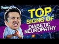 Surprising Signs &Symptoms of Diabetic Neuropathy You Never Knew!