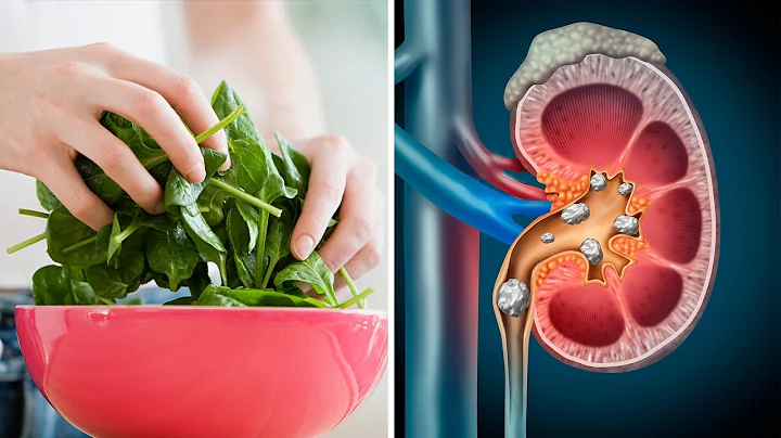 You've Been Eating Spinach Wrong... And This Could Harm Your Kidneys! - DayDayNews