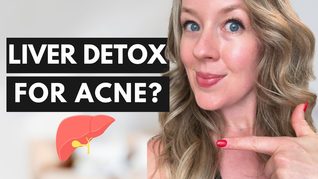 Детоксикация печени при акне — это может быть причиной гормональных прыщей.