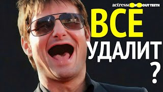 видео: Или оставить 1-2 зуба? НЕ советую..., ПОЧЕМУ_? #протезированиезубов #зубныепротезы #съёмныепротезы картинка: Или оставить 1-2 зуба? НЕ советую..., ПОЧЕМУ_? #протезированиезубов #зубныепротезы #съёмныепротезы