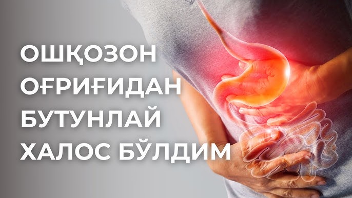 Giantesalar va Liliputlar fotosurati