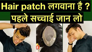 Doubts About Hair Patch Hair Patch Good Or Bad ? Hair Patch For Men 