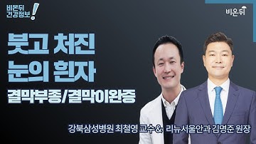 [안과 라이브] 