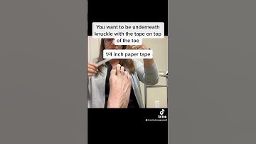 Doctor demonstrates How to get rid of ball of foot pain with simple splinting! #shorts #capsulitis