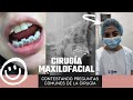 20 Preguntas frecuentes de la cirugía maxilofacial