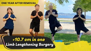 My New Life After +10.7 cm (4.2 inch) Limb Lengthening | One Year After Surgery, Back to Normal Life
