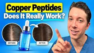 Do Copper Peptides Really Work for Hair Loss?