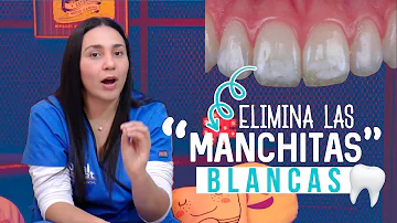 ¿Cómo deshacerse rápidamente de las manchas blancas en los dientes en casa?