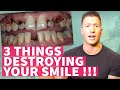 The 3 Things That Will Destroy Your Smile!