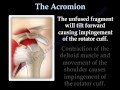 The Acromion Os Acromiale Everything You Need To Know Dr Nabil Ebraheim 
