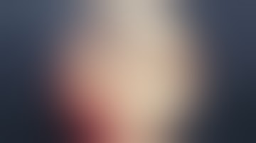 Hậu quả của U tuyến tiền liệt để lâu ngày.TTƯT.TS.BS.Dương Văn Trung☎️0913534343.web:soithan.net.vn