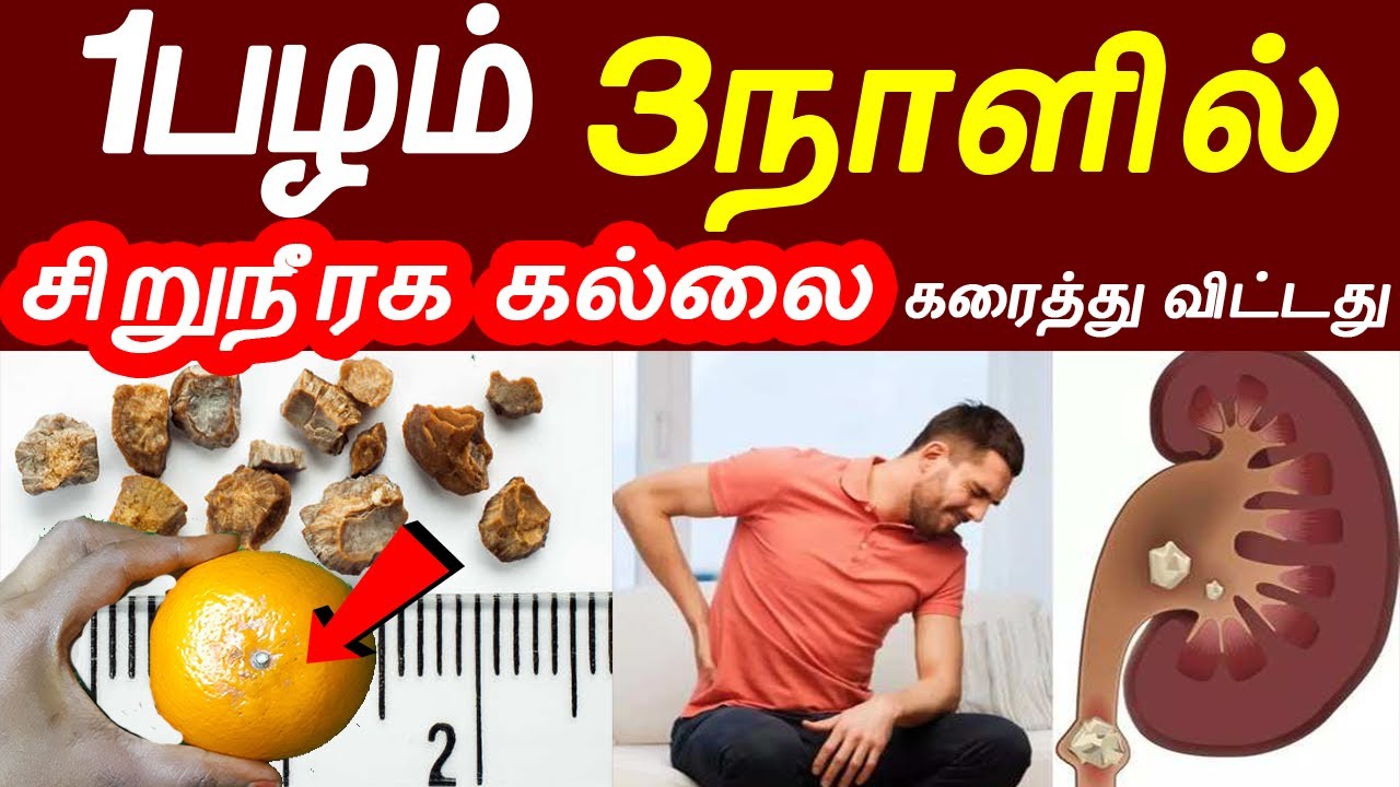 1பழத்தால் எனக்கு சிறுநீரக கல் கரைந்து விட்டது Foods for kidney stones