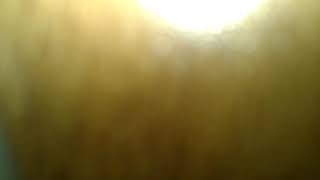 İlyas Yalçıntaş Bilmece Cover (Svas Arslan)