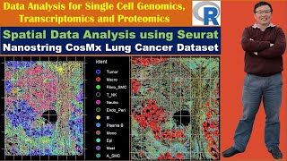 Spatial Data Analysis using Seurat: Nanostring CosMx Lung Cancer Dataset