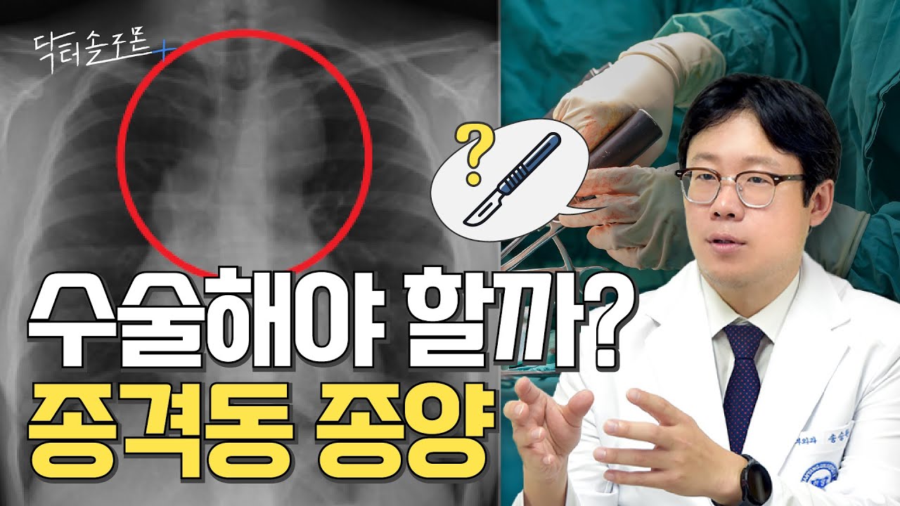 "뭐가 보이네요?" 종격동 종양, 수술해야 할까? 증상도 함께 확인하세요! | 닥터솔로몬