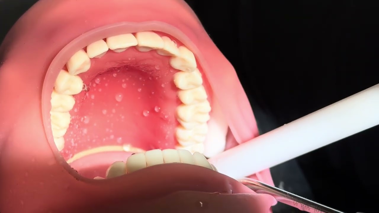 HVE Positioning, Cotton Roll Placement, Limited and Full Mouth Rinses! (From Assisting side). 