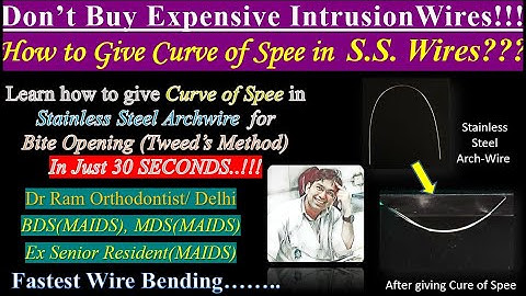 Curve Of Spee in SS Archwire - Tweed