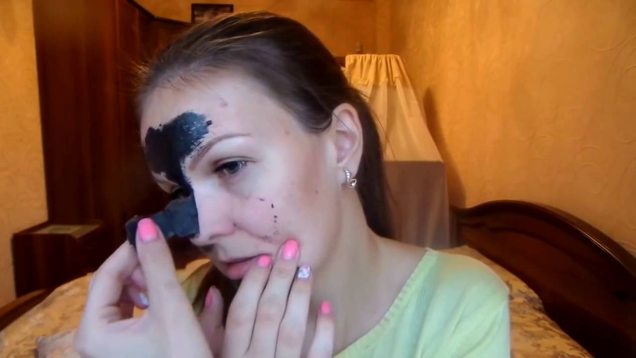 Удаление Гноя Из Пор Носа [Можно Ли Давить Черные Точки На Носу] - YouTube