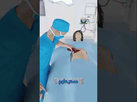 جراح يضع علامة تجارية على كبد المريض