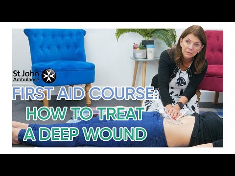 Como tratar cortes profundos e facadas | Mamãe Canal & St John Ambulance