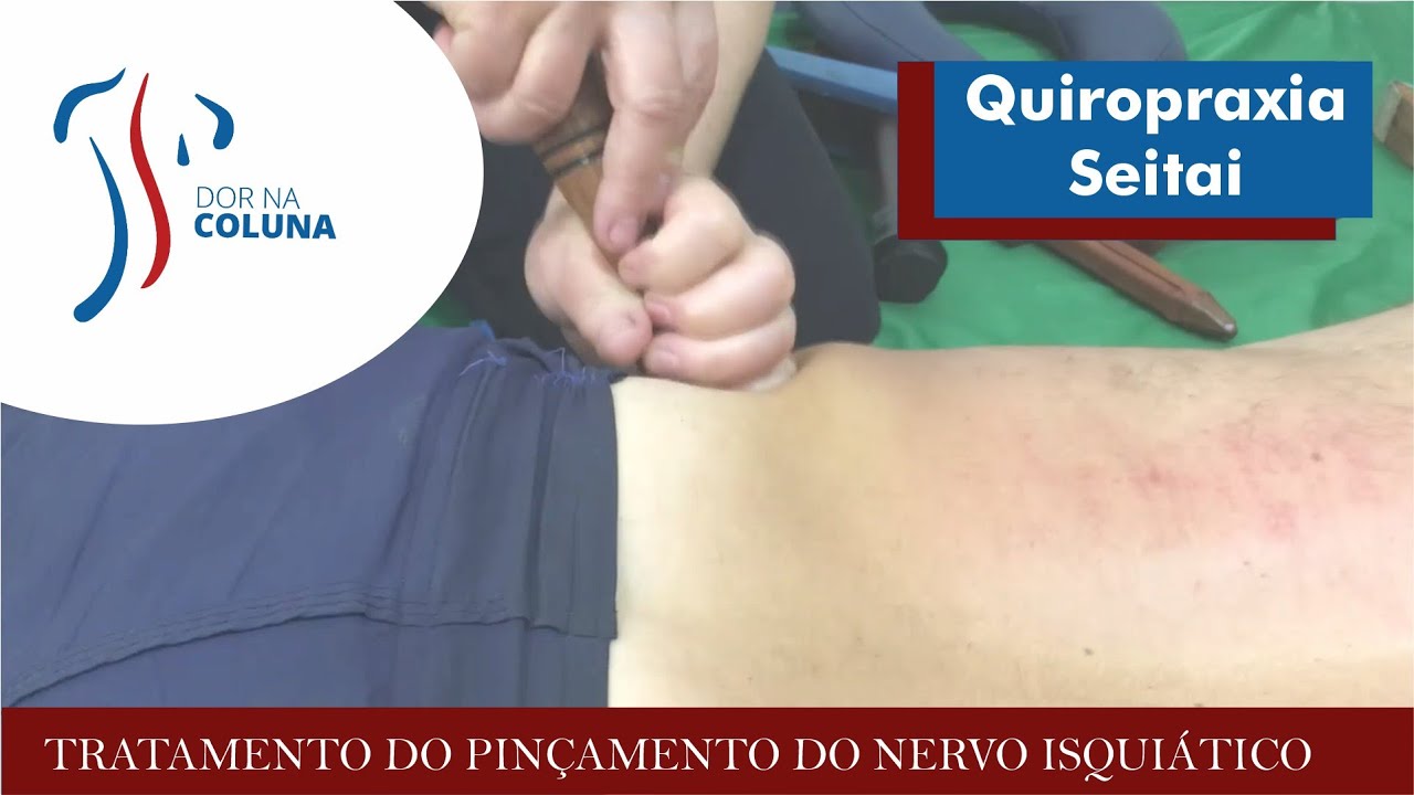 Curso Seitai Manual e Seitai dos Martelos - Pinçamento do Nervo isquiático na prática