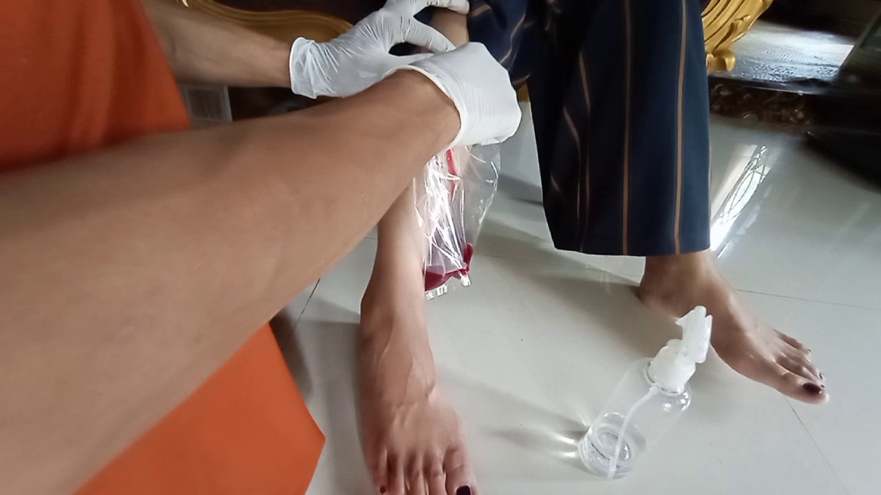 Cara Mengobati Varises SUNTIK VARISES , CARA MENGOBATI VARISES - YouTube