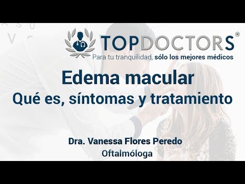 Vídeo: Edema Macular Diabético: Síntomas, Tratamiento Y Más