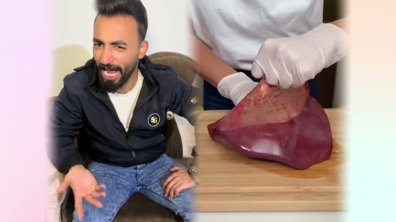 #الطفل الاعمى المعجزه #محضوره_من_الاكسبلور_والمشاهدات #علاوي_مارتن #اكسبلور 15_w 🤣👌👌👌مجموعة مق