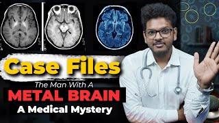 Case Files Ep5 - The Man With A Metal Brain | Dr. Anuj Pachhel