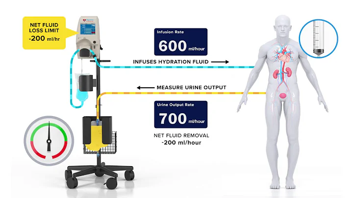 Reprieve Cardiovascular Guided Diuretic Therapy