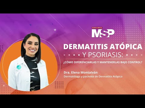 Video: ¿La psoriasis y el eccema son lo mismo?