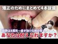 【矯正密着EP3】矯正のため健康な歯とさようなら…まとめて４本抜きます【ノーカット】