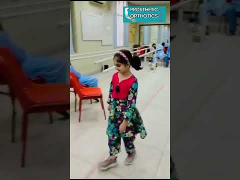 'Amputee Kids: Finding Strength and Resilience How little girl Walks Again with a Prosthetic Leg