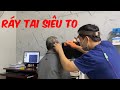 RÁY TAI SIÊU TO KHỔNG LỒ / LẤY RÁY TAI QUA NỘI SOI / MIỀN TON 19