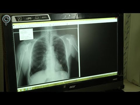Накануне Всемирного дня