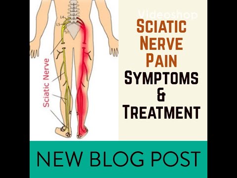 SIDA LOO DAWEEYO NERVAHA AMA CIRIQNISAA SCAITIC NERVE PAIN